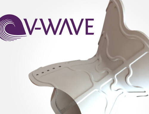 Johnson & Johnson to Acquire V-Wave